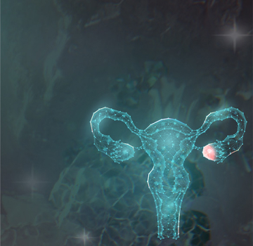 eierstockkrebs header
