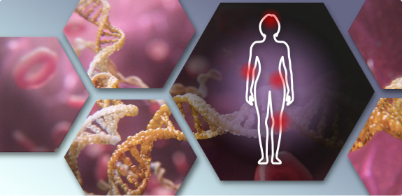Symptome bei Systemischem Lupus Erythematodes