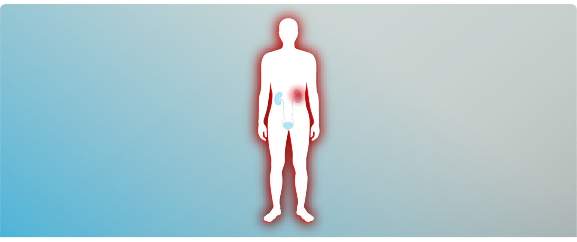 Image Highlighting Internal Organs regarding Secondary Disease Development